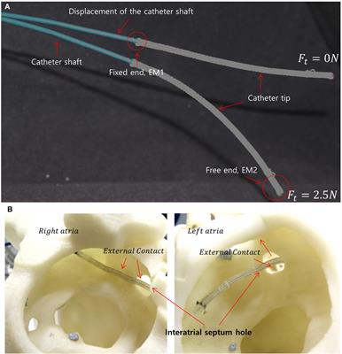 Model-Free Position Control for Cardiac Ablation Catheter Steering Using Electromagnetic Position Tracking and Tension Feedback